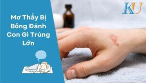 Mơ Thấy Bị Bỏng Đánh Con Gì Trúng Lớn